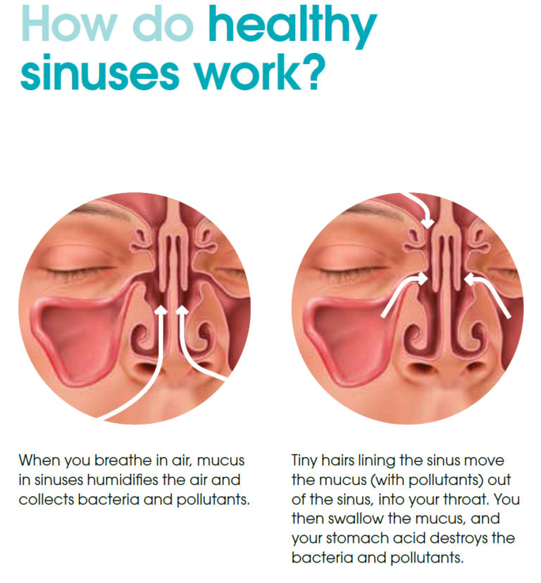 Sinus Problems Dr. James Go